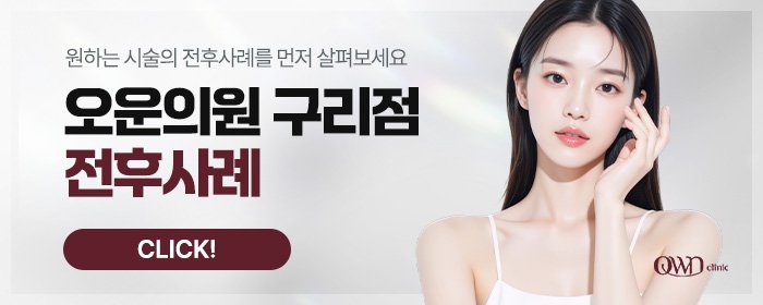 별내 얼굴 리프팅